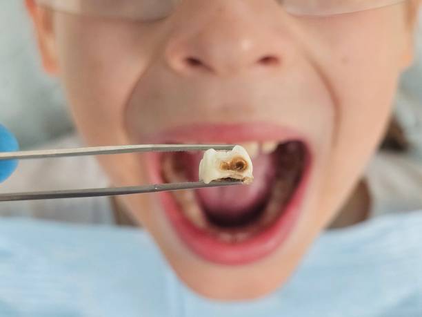 Best Urgent Dental Care for Toothaches in Hayfield, MN